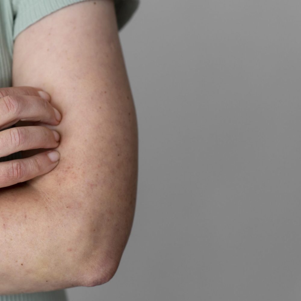 skin-allergy-person-s-arm-with-copy-space